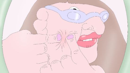 PIMPLE1-min—sara-priorelli